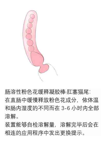 第394页图